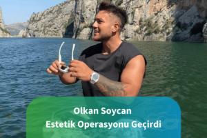 olkan soycan estetik operasyon geçirdi